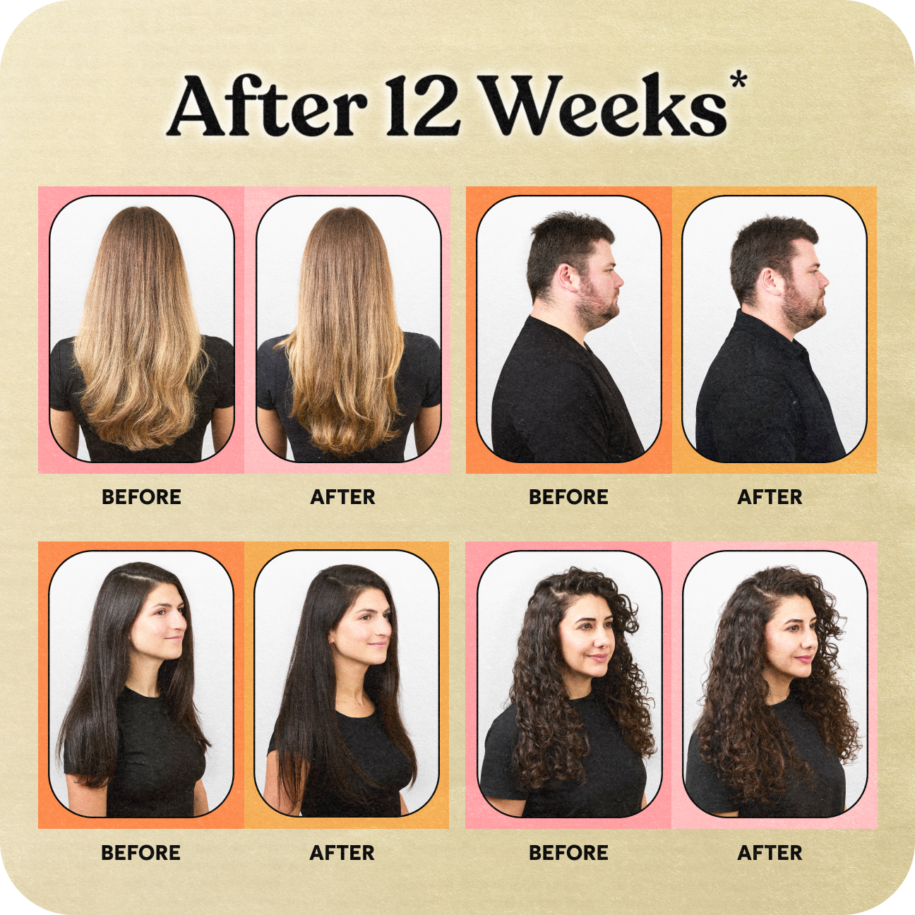 Before and after hair growth results after 12 weeks shown on a beige background.