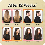Before and after hair growth results after 12 weeks shown on a beige background.